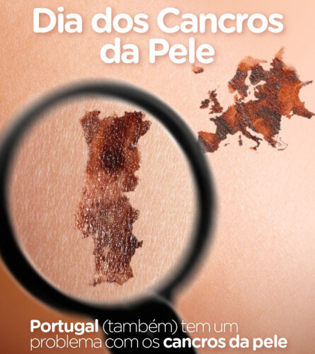 dia-dos-cancros-de-pele