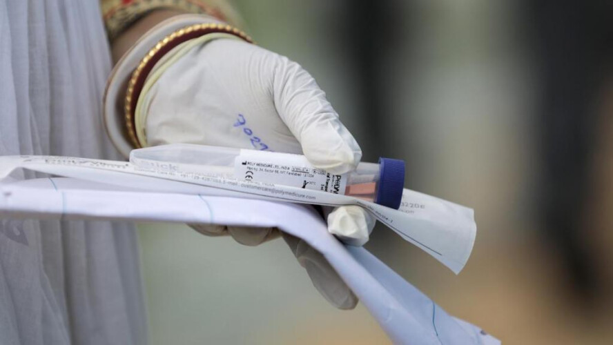 covid-19-portugal-com-mais-uma-morte-e-598-novos-casos-de-infecao