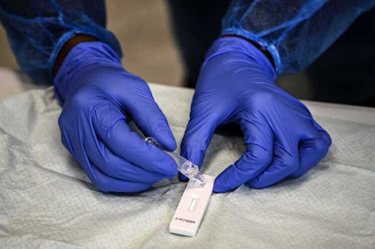 covid-19-testes-rapidos-chegam-esta-sexta-feira-a-500-farmacias