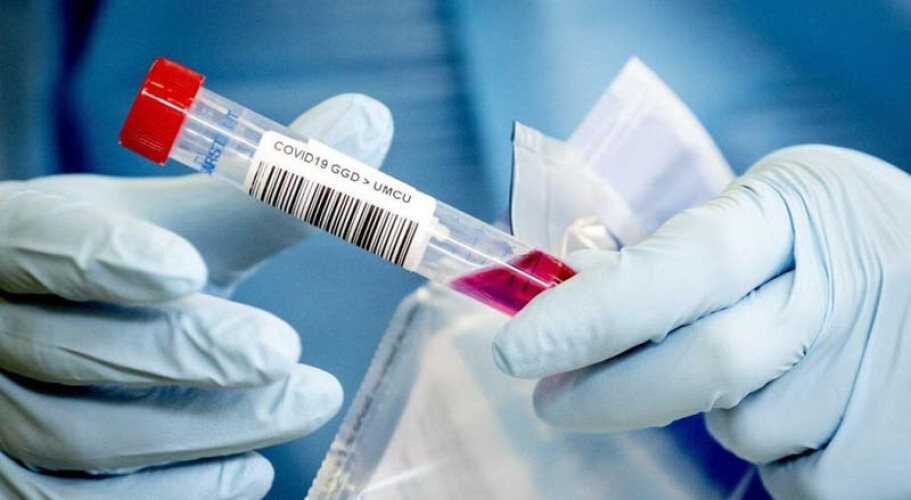 covid-19-portugal-com-mais-duas-mortes-e-501-casos-de-infecao