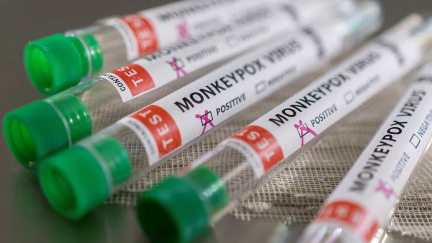 portugal-vai-receber-2700-doses-das-vacinas-contra-o-virus-monkeypox