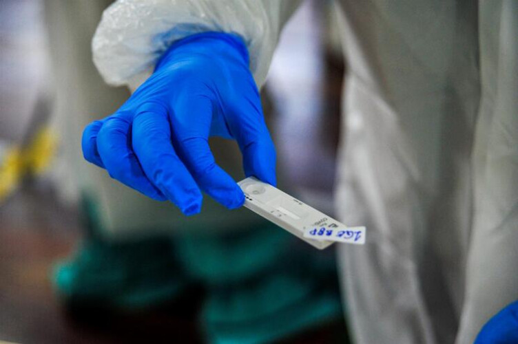 portugal-vai-receber-cerca-de-um-milhao-de-testes-rapidos-de-antigenio