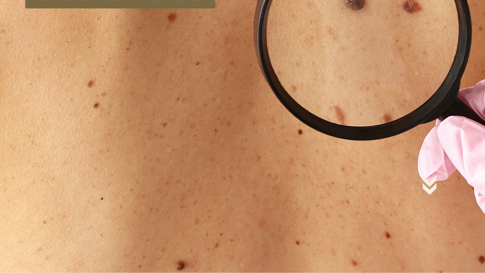 Celorico de Basto promove campanha de prevenção do cancro da pele