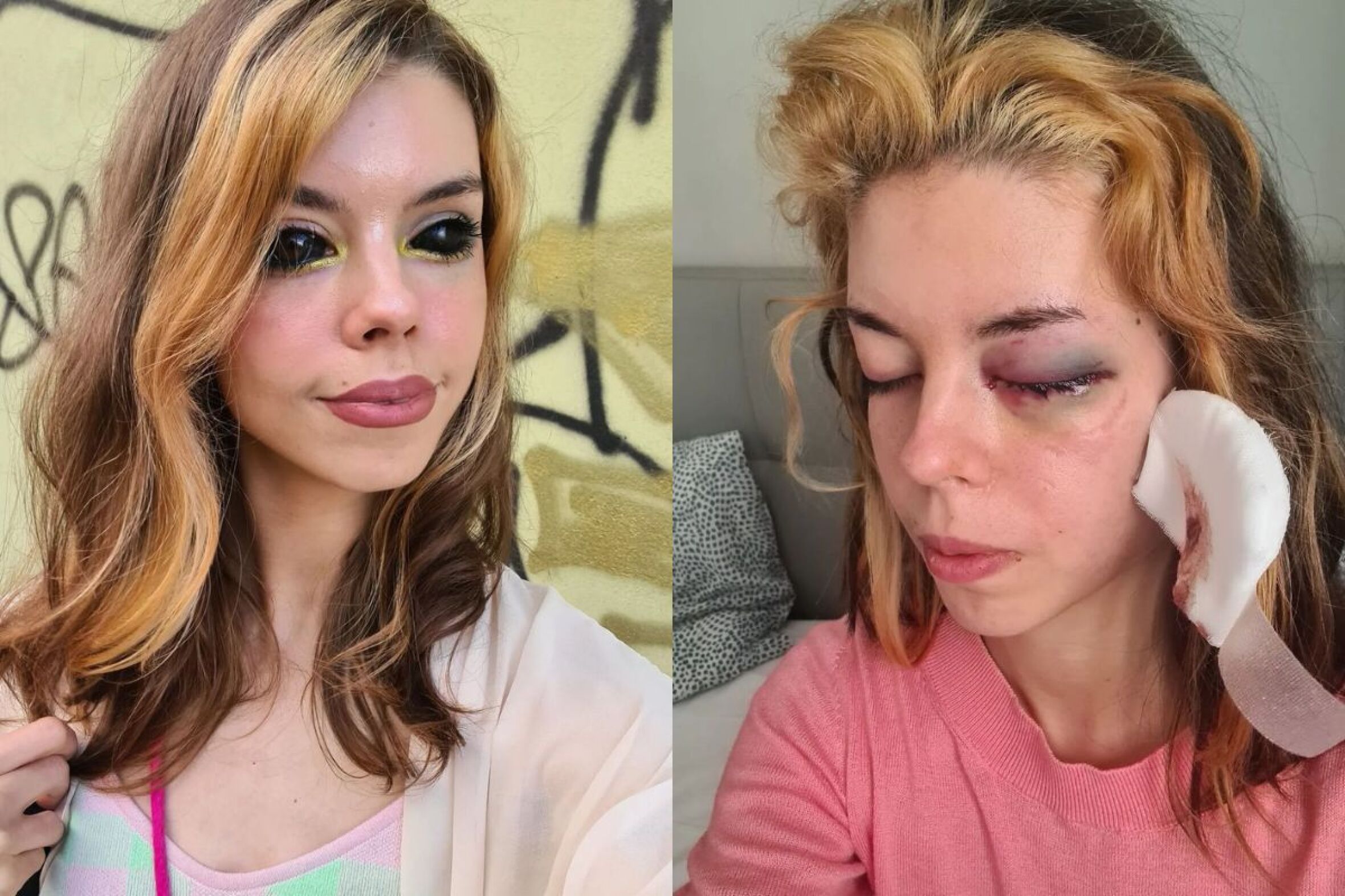 Tatuou os olhos e quase ficou cega. Agora processou o tatuador