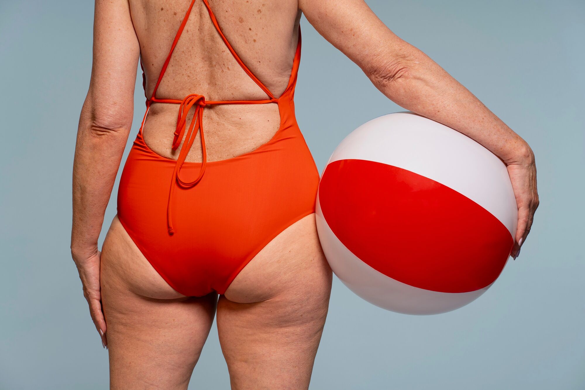 N&atilde;o &eacute; s&oacute; celulite. Respondemos &agrave;s quest&otilde;es mais comuns sobre lipedema